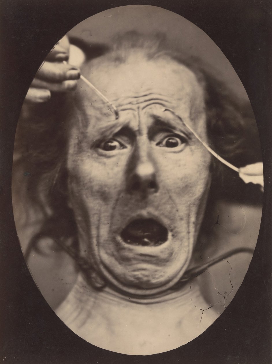Electro-Physiologie, figur 64, 1854-56, trykt 1862. af Adrien Alban Tournachon