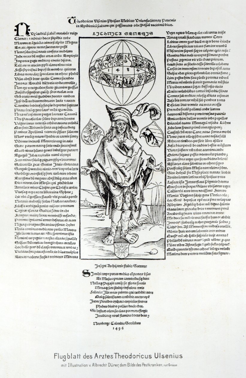 Illustration af syfilis, 1496 af Albrecht Dürer