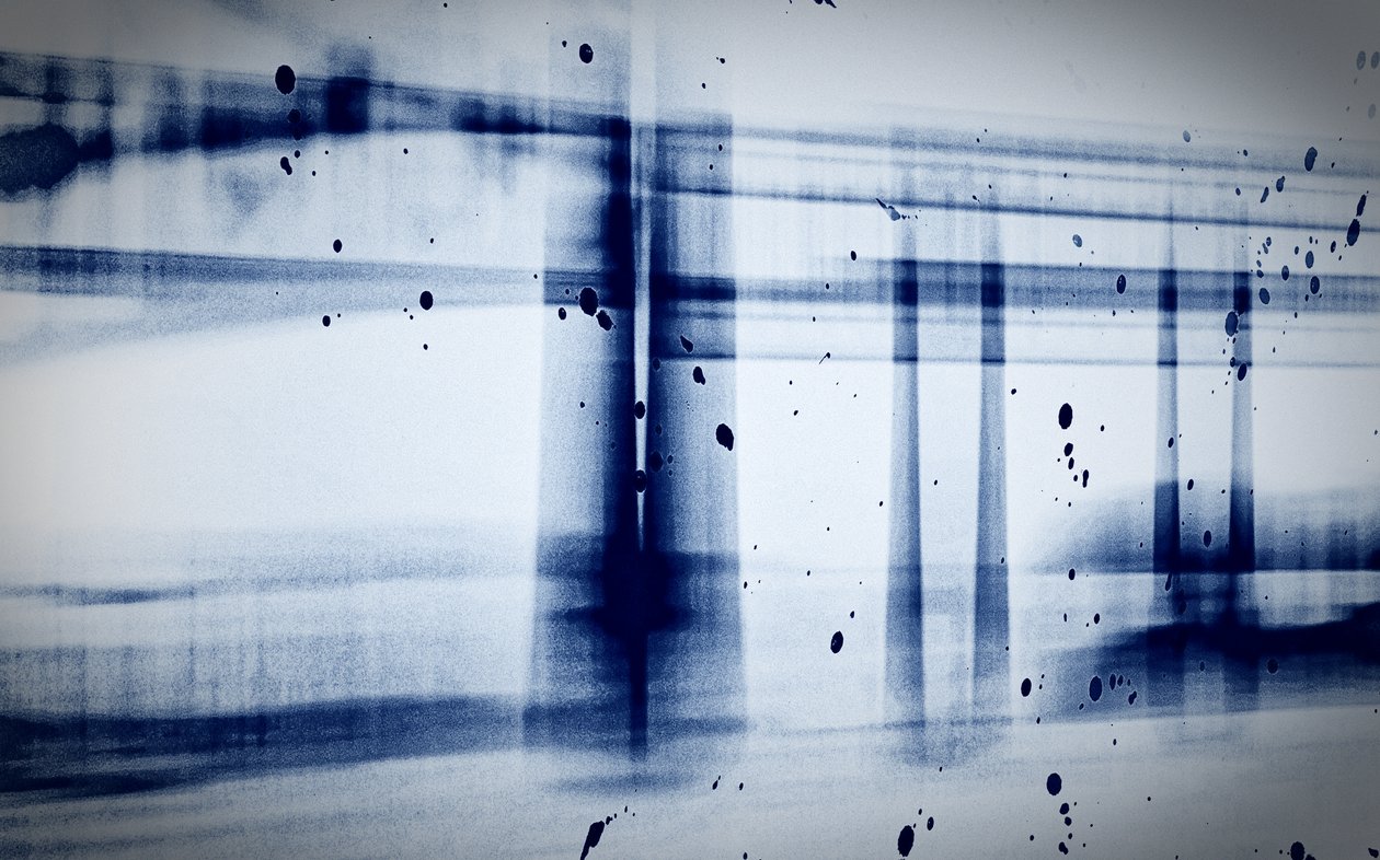 Sne (røntgen), 2019, (fotografi) af Alex Caminker