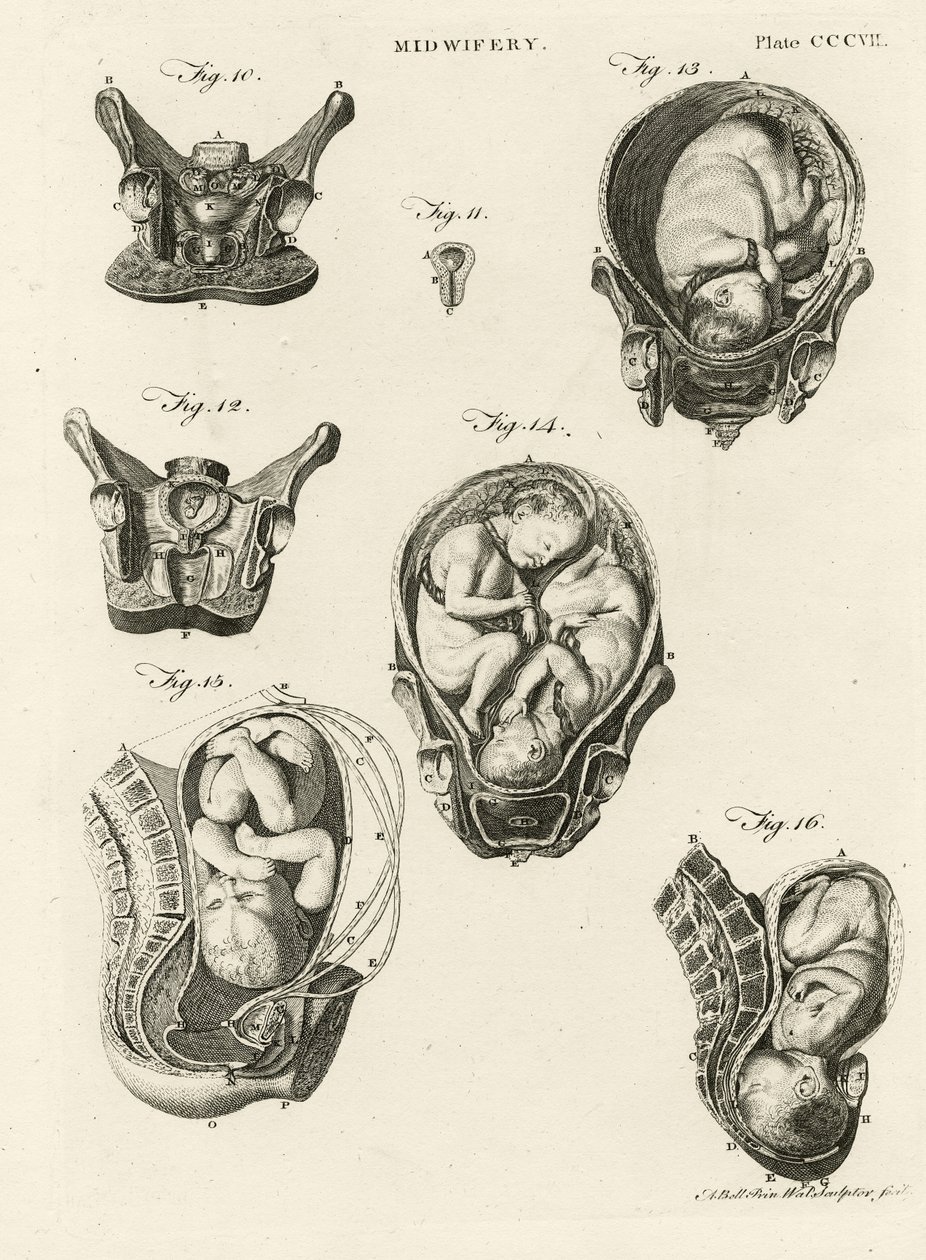 Jordemoder, illustration fra 