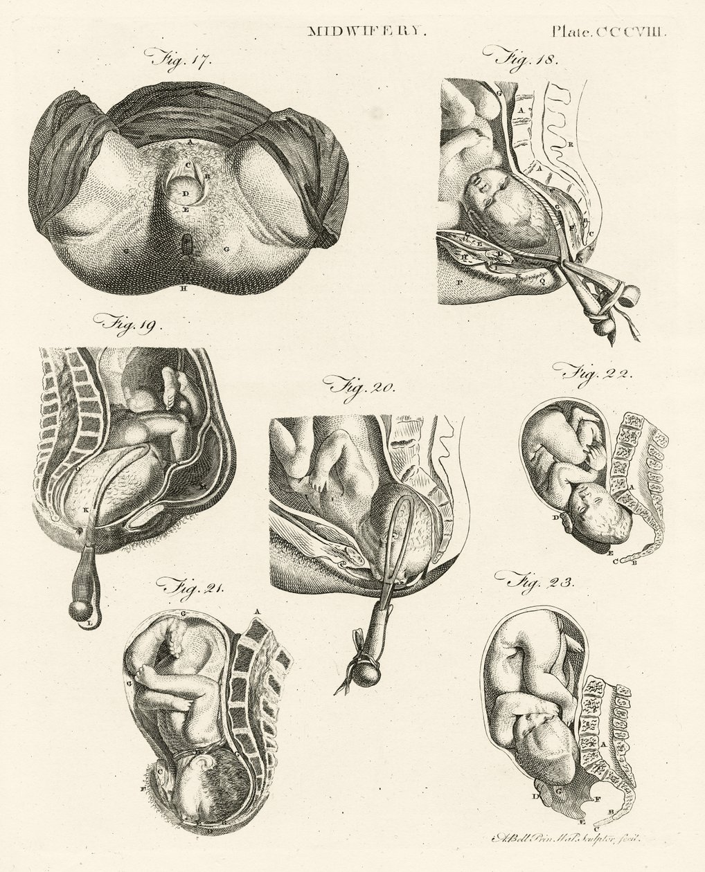 Jordemoder, illustration fra 