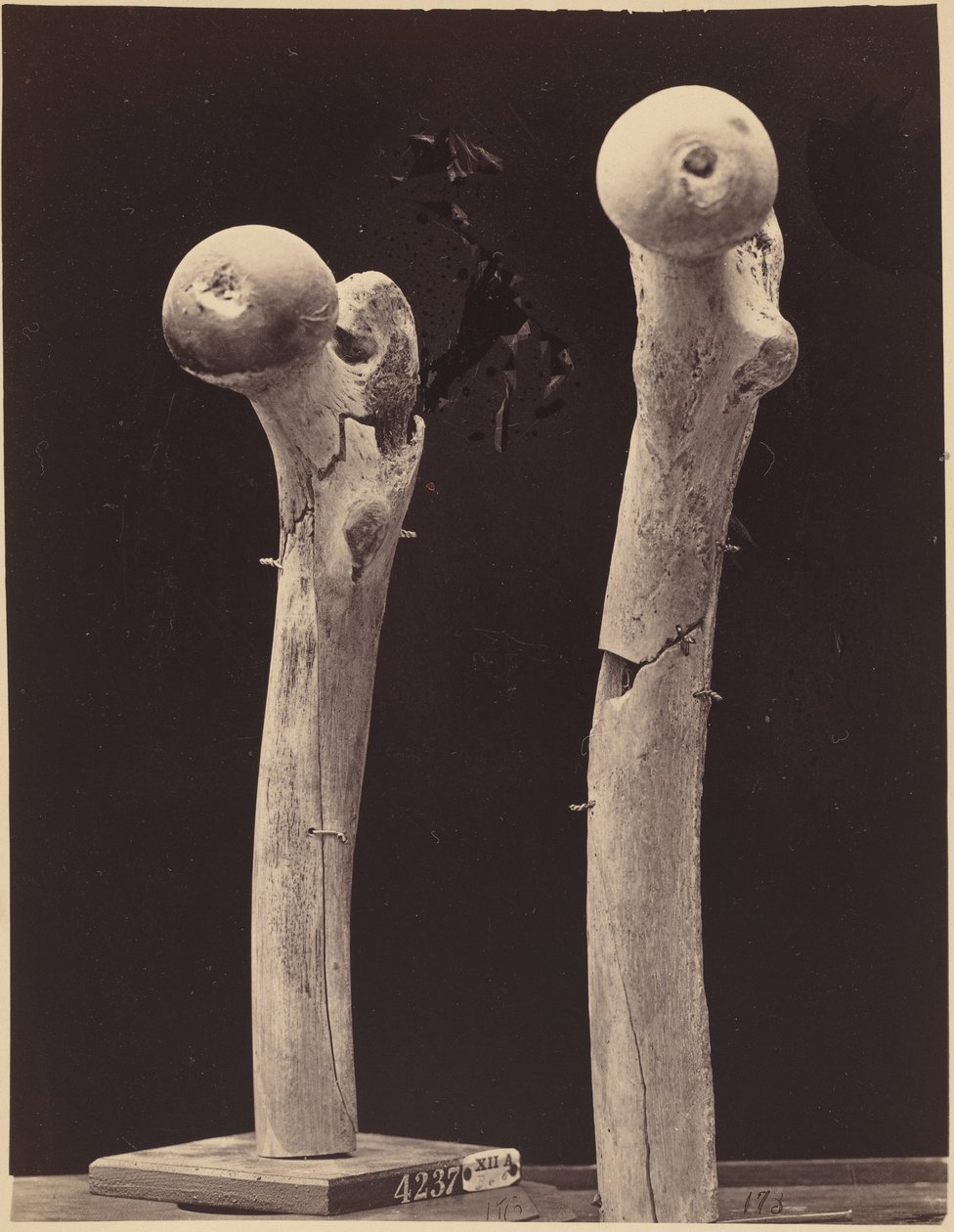 Prøver af skudfrakturer på lårbenet, ca. 1867 (foto) af American Photographer