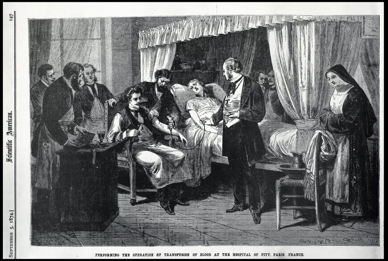 Udførelse af operationen af transfusion af blod på Hospital of Pity, Paris, Frankrig, illustration fra den amerikanske videnskabsmand af American School