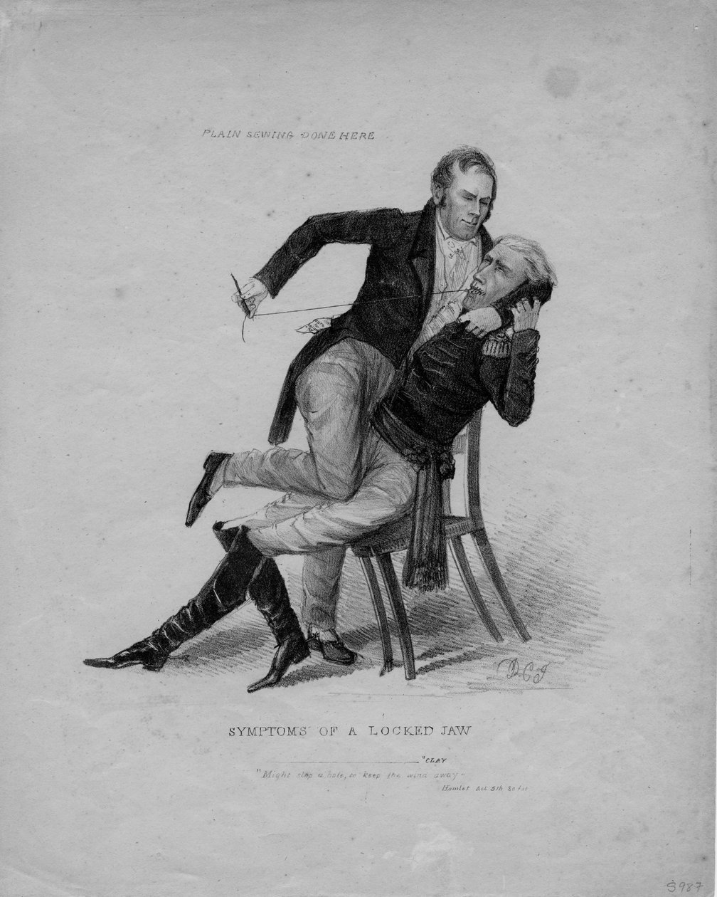 Symptomer på en låst kæbe, ca. 1827 af American School