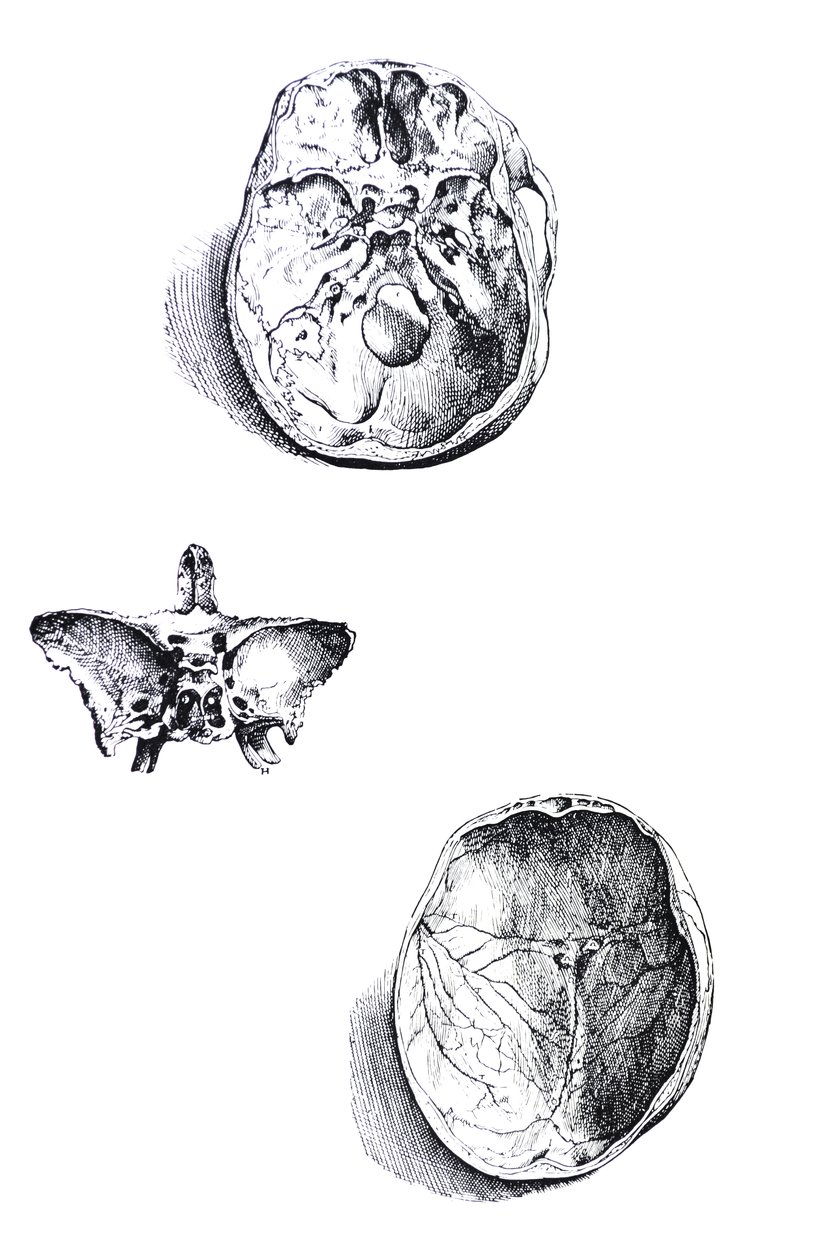 Pladerne fra den første bog af De Humani Corporis Fabrica af Andreas Vesalius