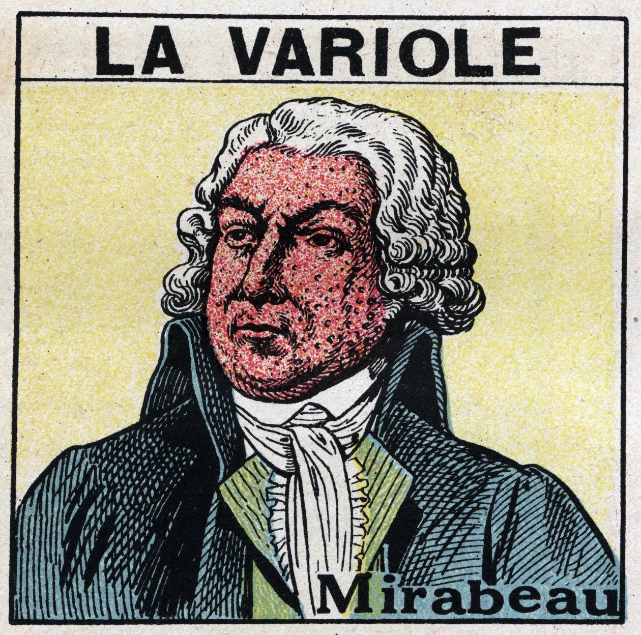 Portræt af Honore Gabriel (Honore-Gabriel) Riqueti, greve af Mirabeau (1749-1791) med ansigtet af en figur af kopper. For at undgå ar forårsaget af kopper, bør patienter behandles i værelser eller kun gå ind i rødt lys, fri for ultraviolette stråler. Anony af Anonymous Anonymous