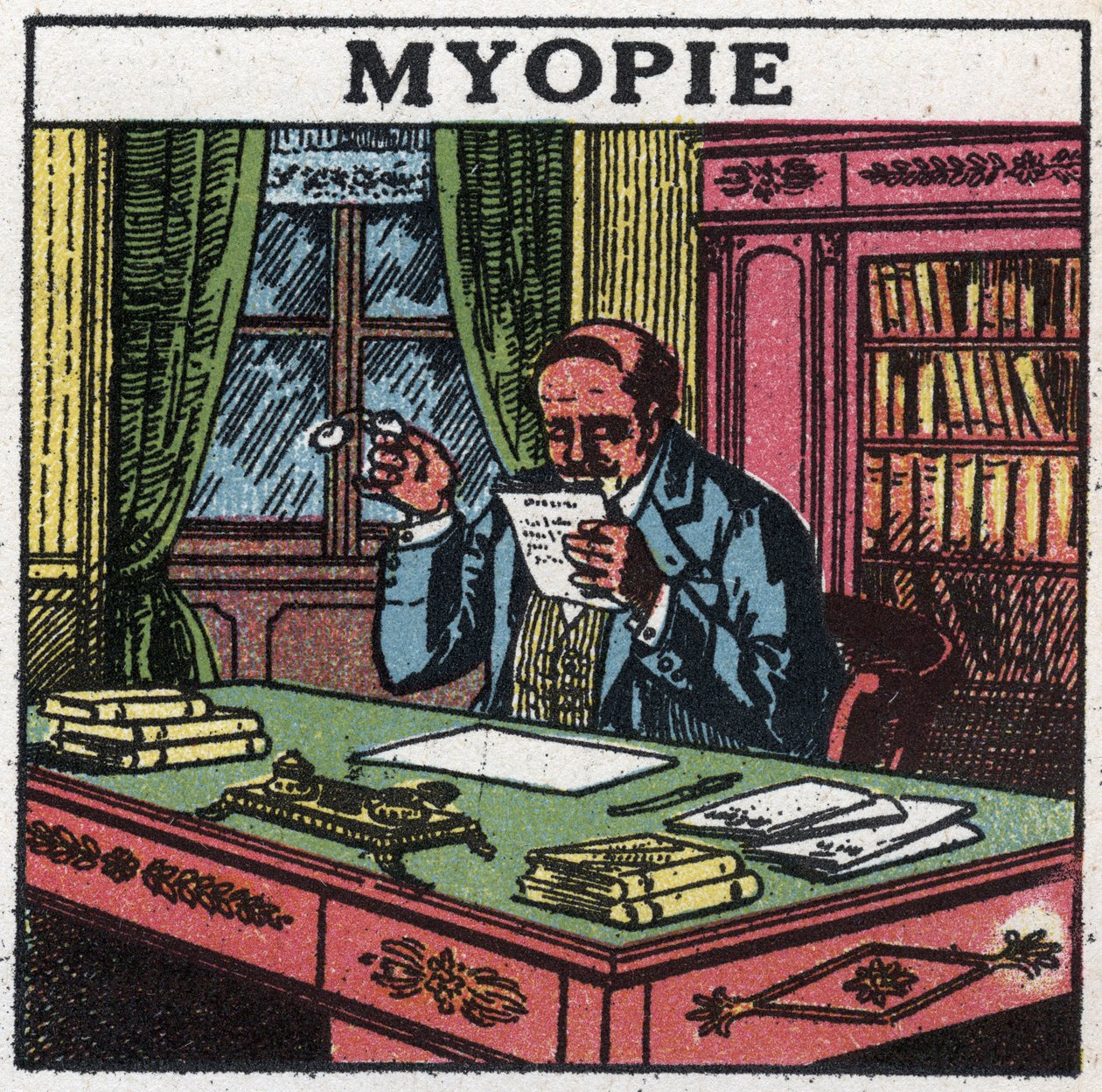 Øjet: person, der lider af nærsynethed. Anonym illustration fra 1925. Privat samling. af Anonymous Anonymous