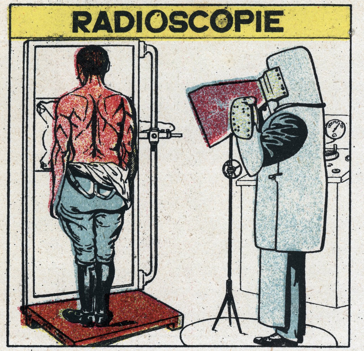 Røntgen: radioskopi af en menneskekrop. Radiologen beskytter sig mod røntgenstråler ved at bære en gummiklud med en gummiopløsning indeholdende blysalte, hans hoved er dækket af en kasket og hænderne med handsker af samme stof, hans øjne er pr. af Anonymous Anonymous