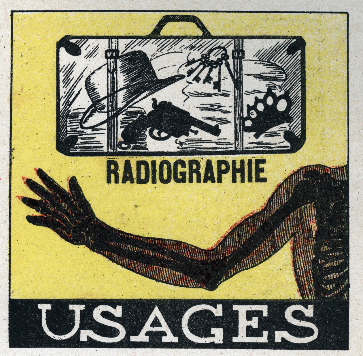 Røntgen: Brug af røntgen til at se gennem genstande og kroppe. Anonym illustration fra 1925. Privat samling. af Anonymous Anonymous