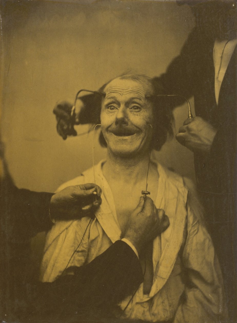 Et falsk, ufuldstændigt udtryk for behagelig overraskelse eller beundring, 1854-1856, trykt 1862. af Duchenne de Boulogne