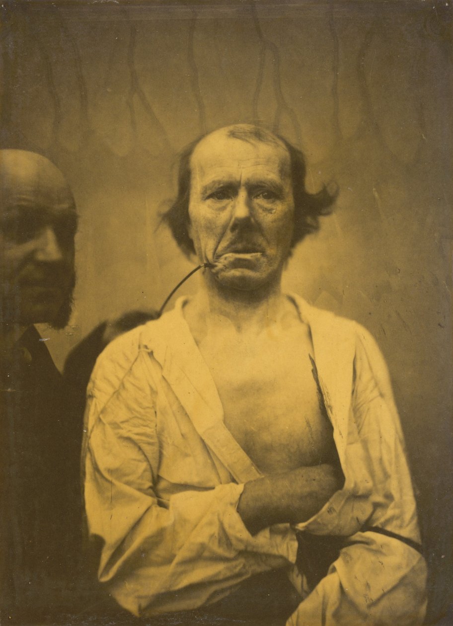 Et afslappet udtryk til venstre, Afsky til højre, 1854-1856, trykt 1862. af Duchenne de Boulogne