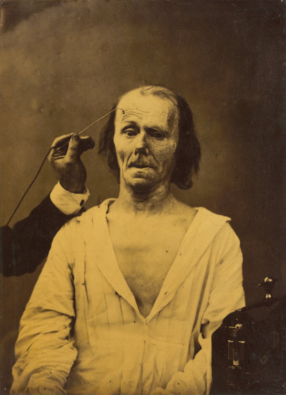 Et afslappet ansigt venstre, dyb opmærksomhed højre, 1854-1856, trykt 1862. af Duchenne de Boulogne