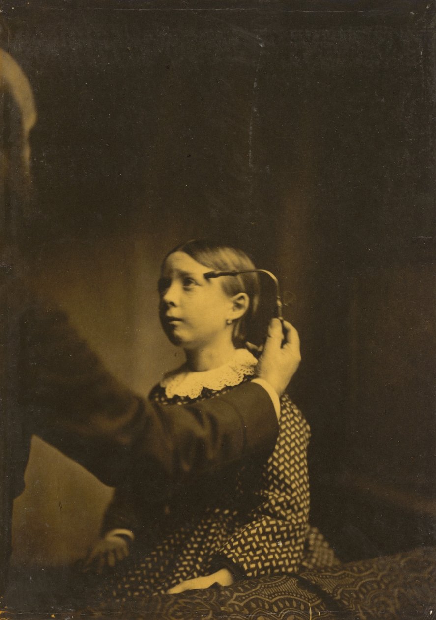 Smertefulde minder, 1854-1856, trykt 1862. af Duchenne de Boulogne
