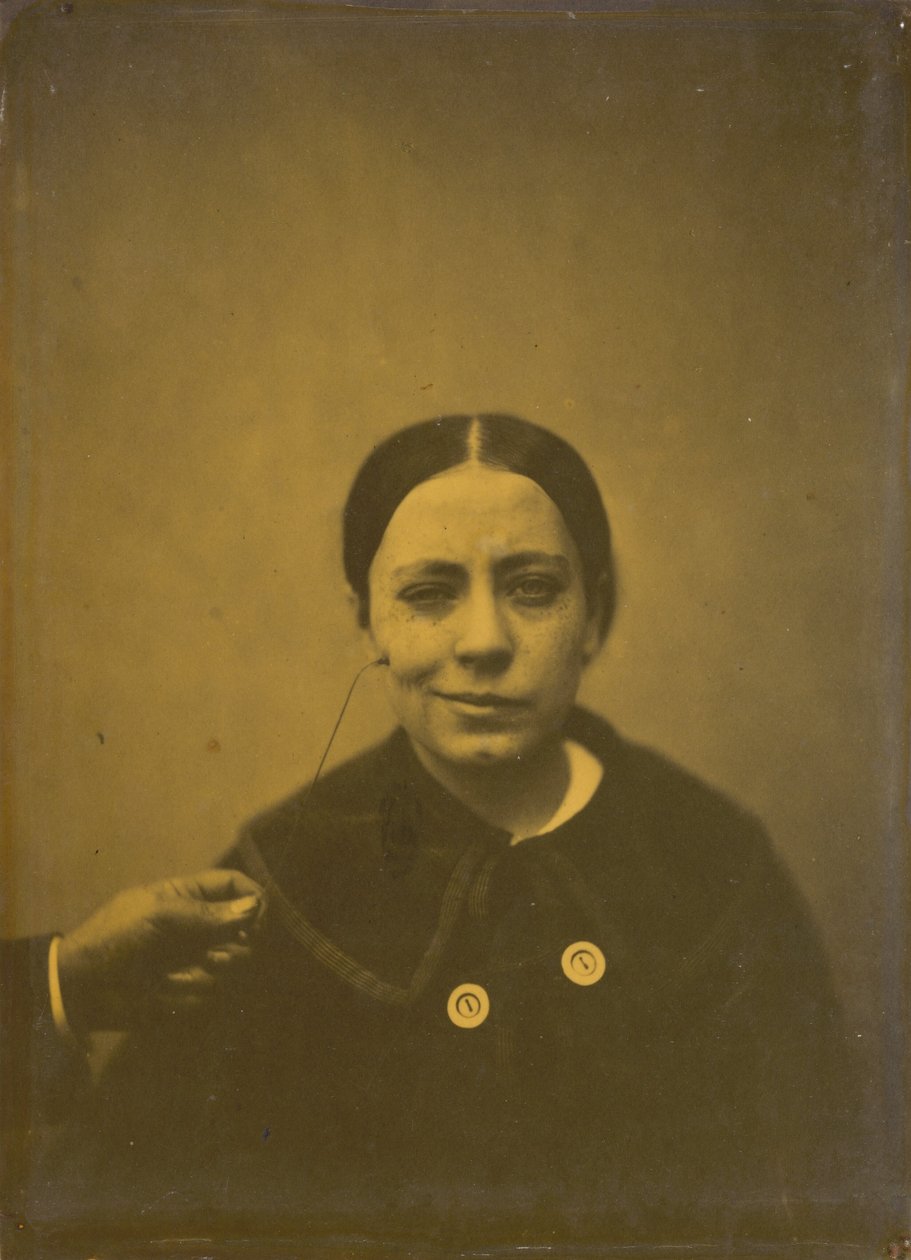 Let sænkning af mundvinklen på grund af depression venstre, falsk latter højre, 1854-185 af Duchenne de Boulogne