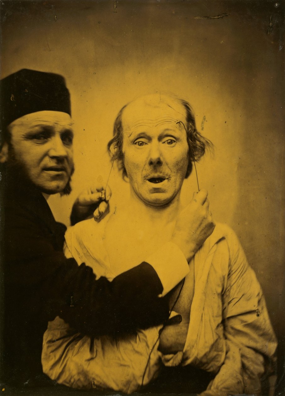 Surprise, 1854-1855, trykt 1862. af Duchenne de Boulogne
