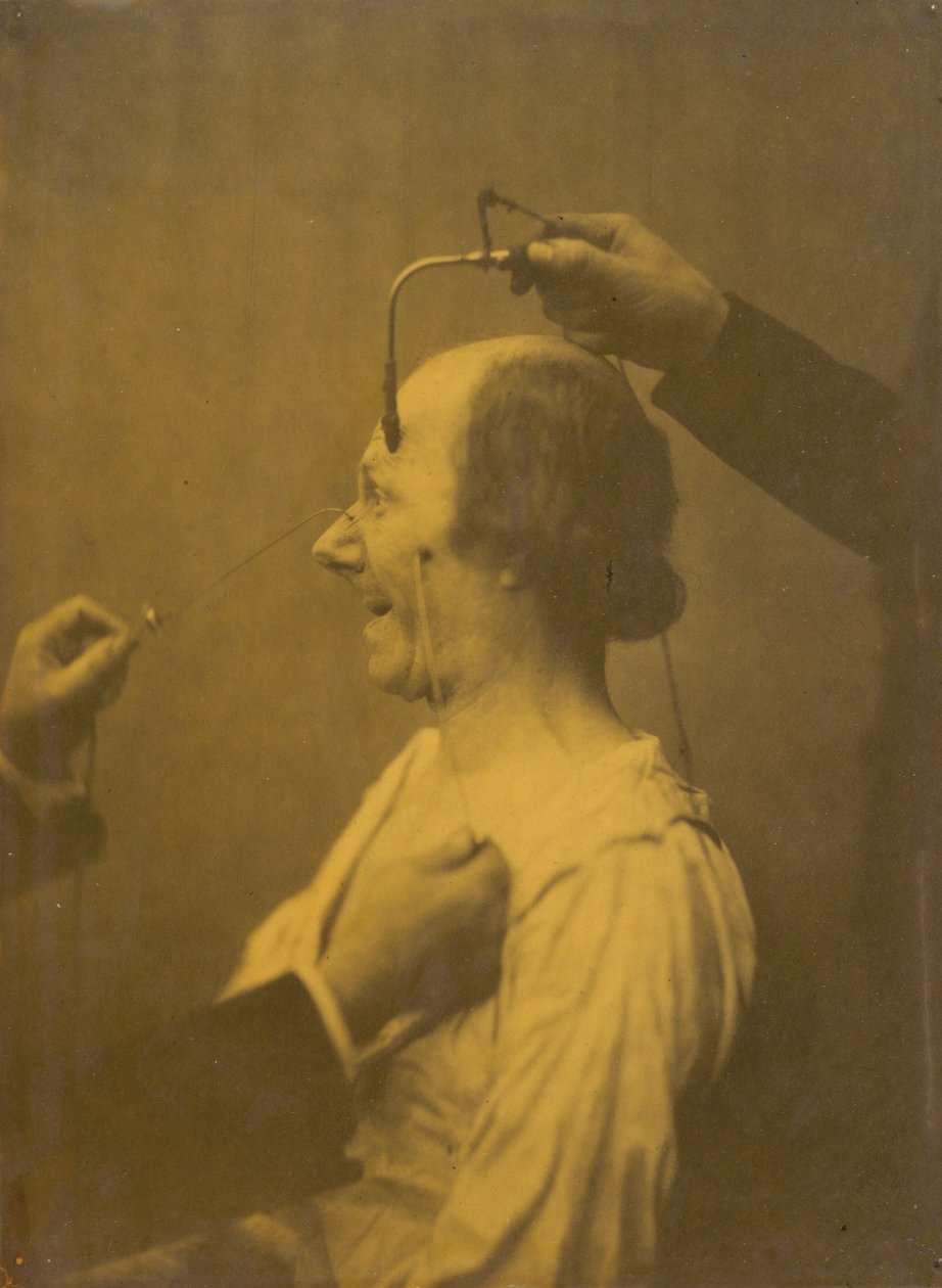 Opmærksomheden tiltrukket af en genstand, der fremkalder liderlige ideer og ønsker, 1854-1856. af Duchenne de Boulogne