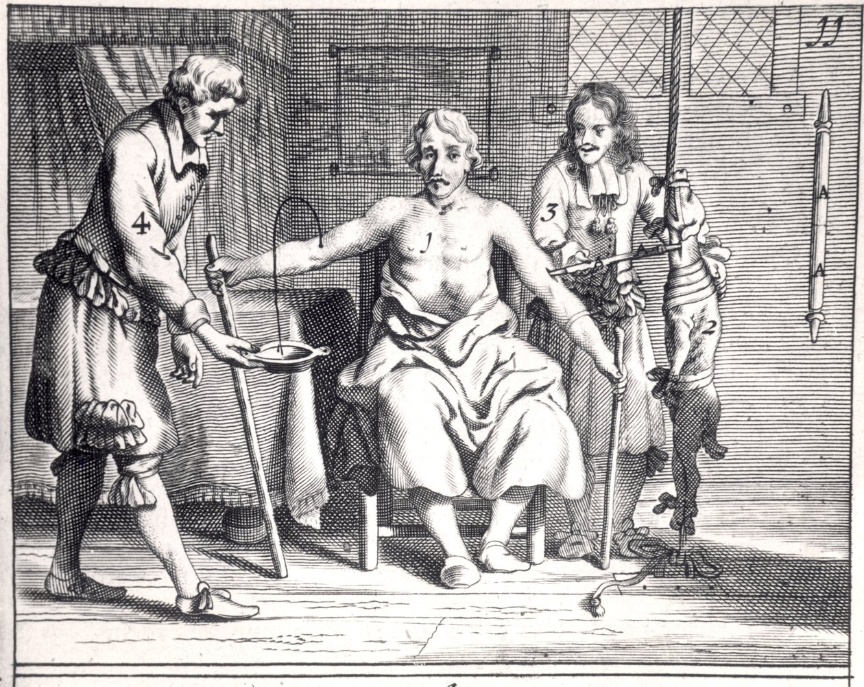 Blodtransfusion fra en hund, fra Armamentarii Chirurgici af Johannes Schultes (1595-1645) udgivet i Amsterdam, 1671 af Dutch School