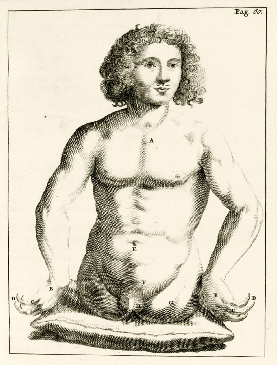 Eksempel på medfødte misdannelser af Frederik Dekkers, 1694 af Dutch School