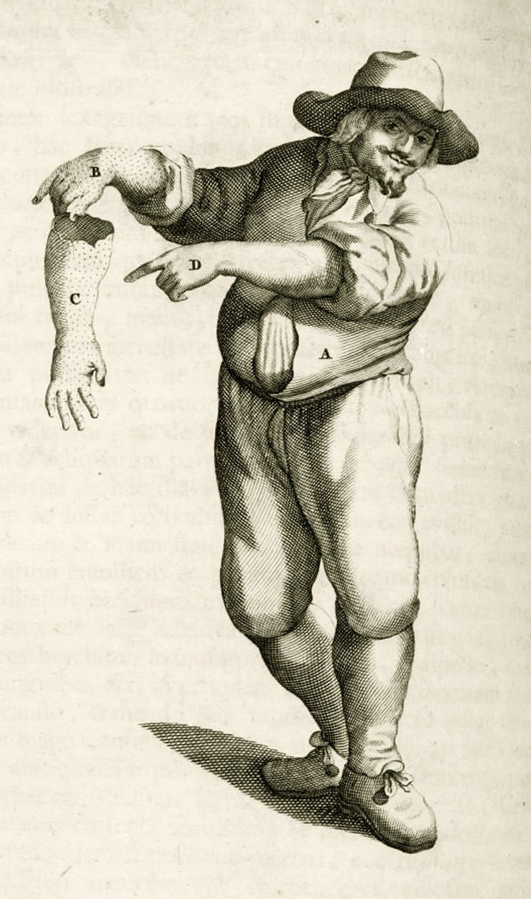 Fjernelse af død hud med pustler, fra Practical Exercises in Medical Methods af Frederik Dekkers, 1694 af Dutch School