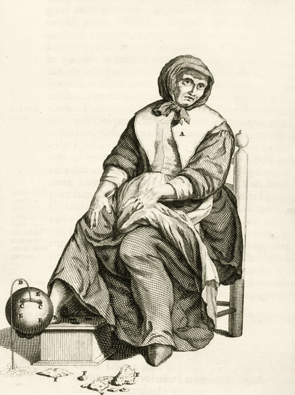 Using a Mechanical Leech, from Practical Exercises about the Method of Healing af Frederik Dekkers, 1694 af Dutch School