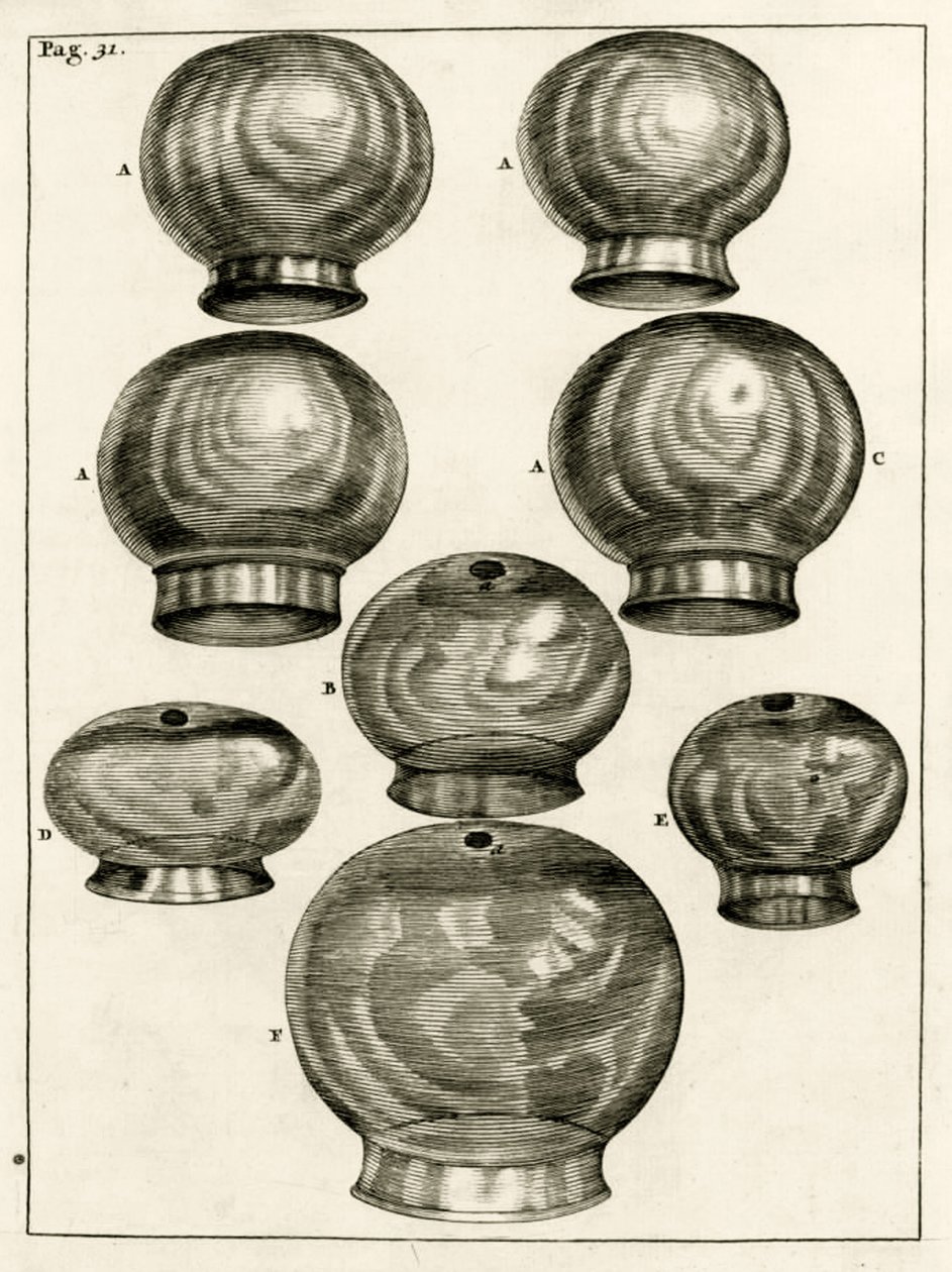 Forskellige cuppingglas, fra The Practice of Medicine af Frederik Dekkers, 1694 af Dutch School