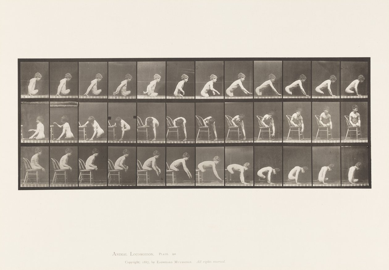 Plade 538. Dobbelt amputation af lår; Dreng; A, Fremad af Eadweard Muybridge
