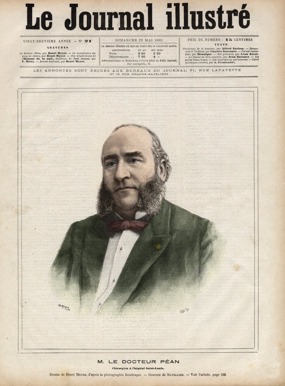 Portræt af Jules Emile (Jules-Emile) Pean (1830-1898), fransk kirurg - Indgravering af Navellier i "The Illustrous Diary"" fra 1892 af Edouard Felicien Eugene Navellier