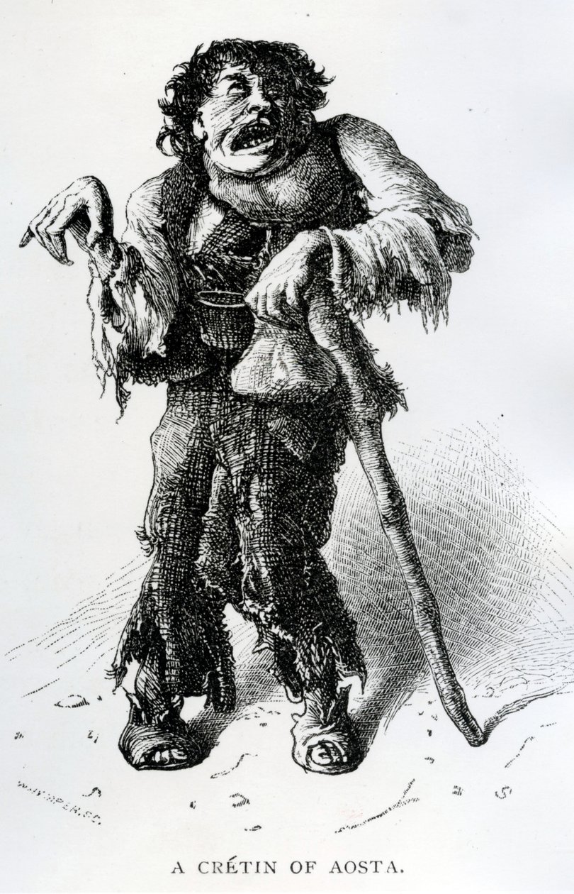 A Crétin of Aosta, ca. 1870 (træstik) af Edward Whymper