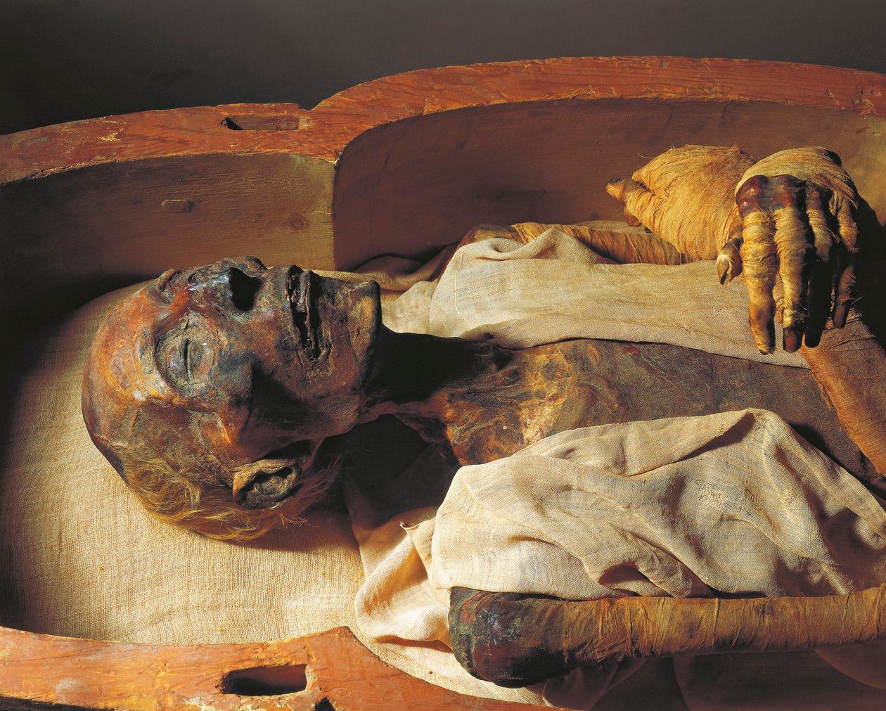 Mumie af Ramses II (ca. 1297-1213 f.Kr.), detalje af Egyptian 19th Dynasty