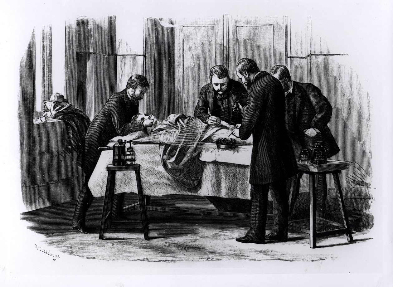 Antiseptisk kirurgi, 1882 af English School
