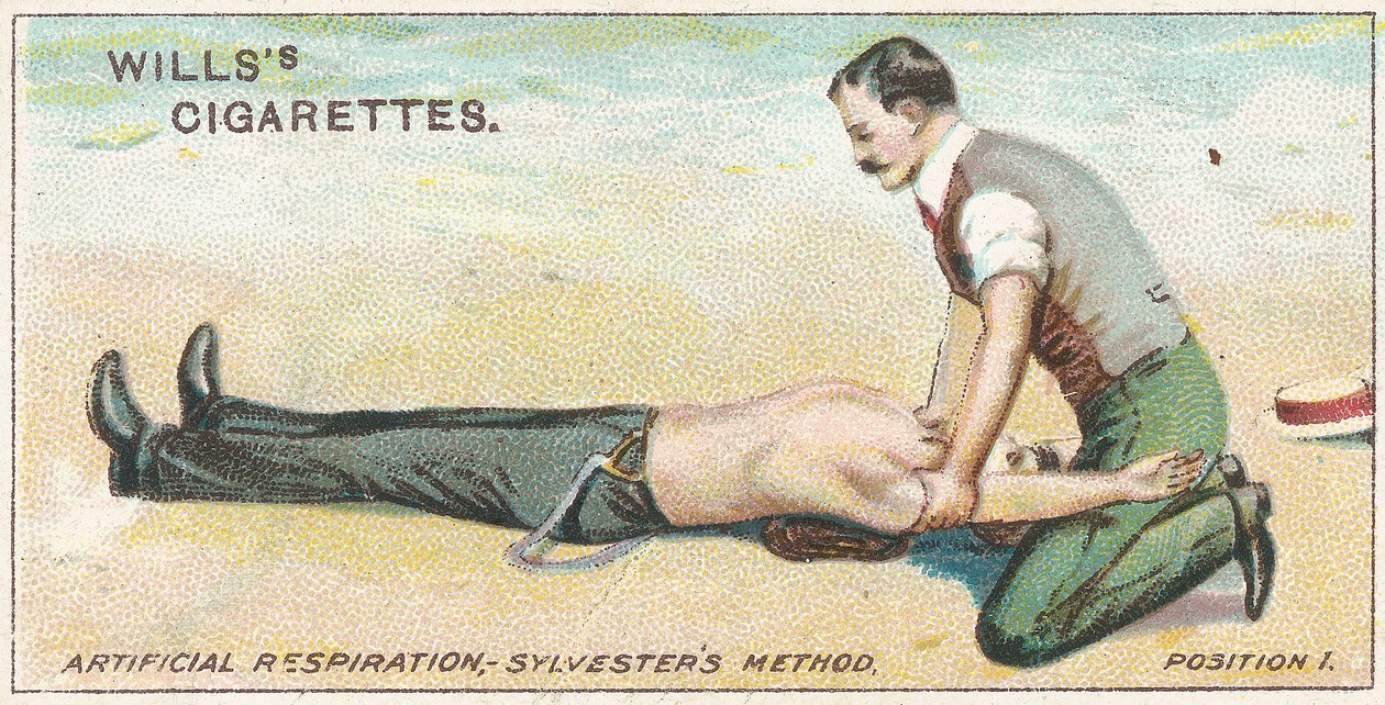 Kunstigt åndedræt, Sylvesters Method - Position 1, nr.17 fra First Aid-serien af Willss Cigarette-kort, 1913 af English School