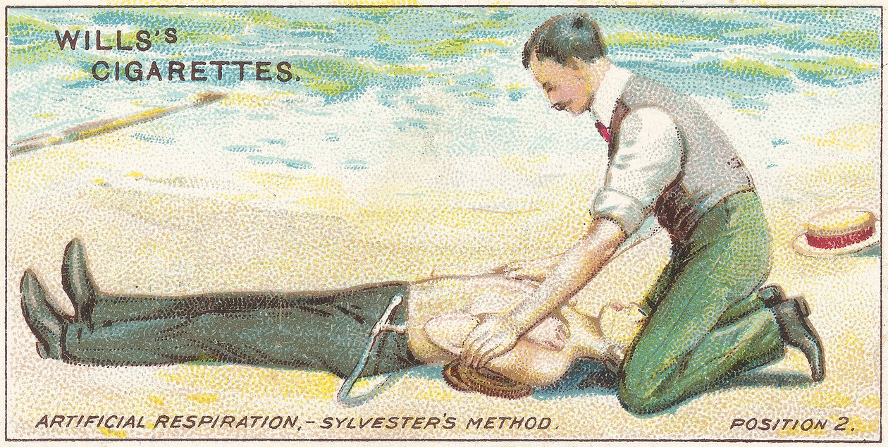 Kunstigt åndedræt, Sylvester