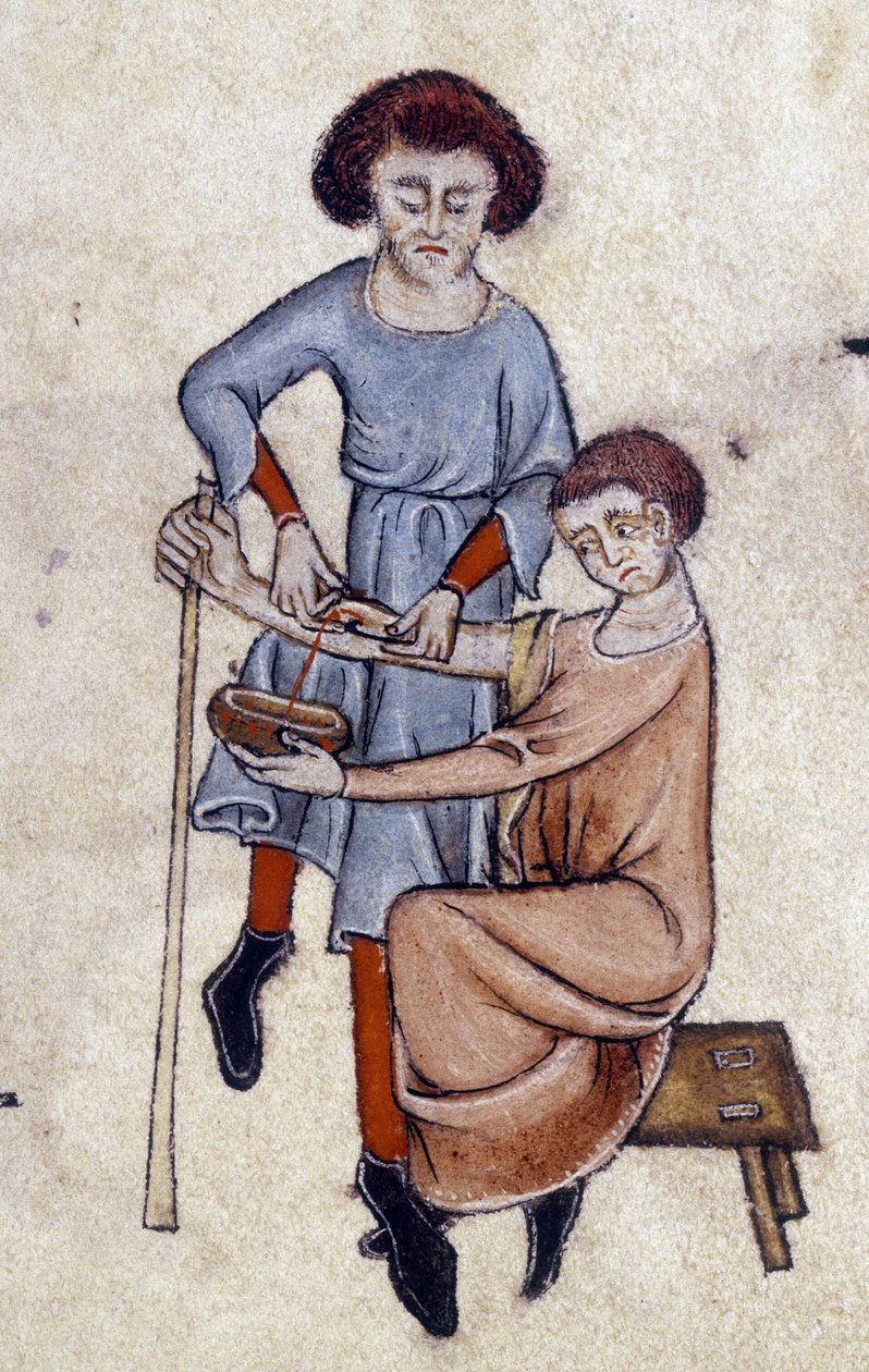 Blood Letting, fra Luttrell Psalter, ca. 1325-35 (vellum) af English School