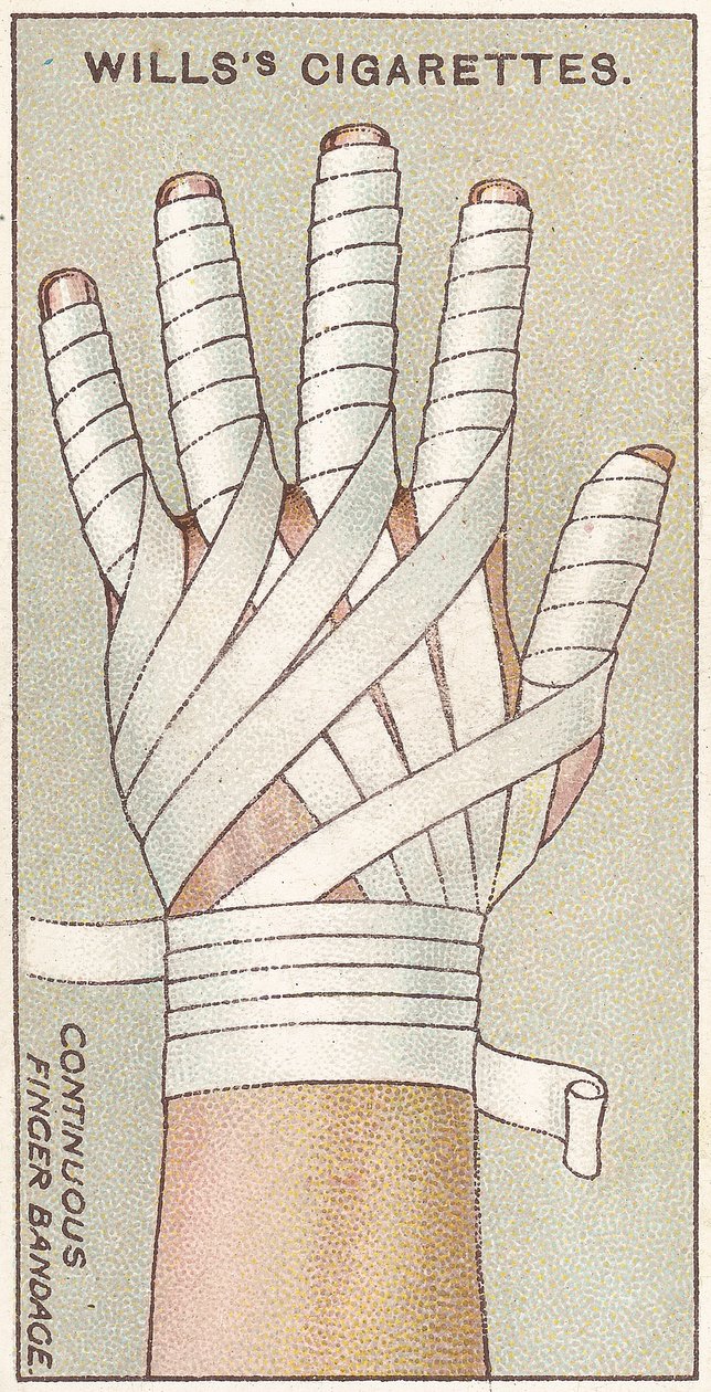 Kontinuerlig Fingerbandage, nr. 48 fra First Aid-serien af Willss Cigarette-kort, 1913 af English School