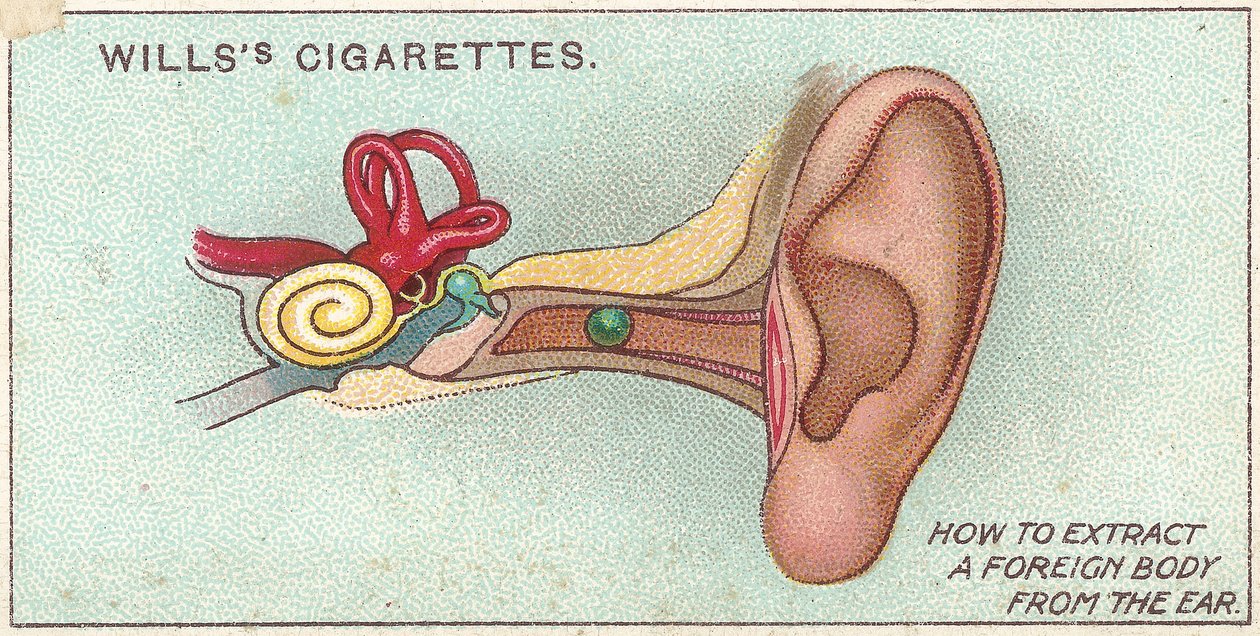 Fremmedlegeme i øret, nr. 30 fra First Aid-serien af Willss cigaretkort, 1913 af English School