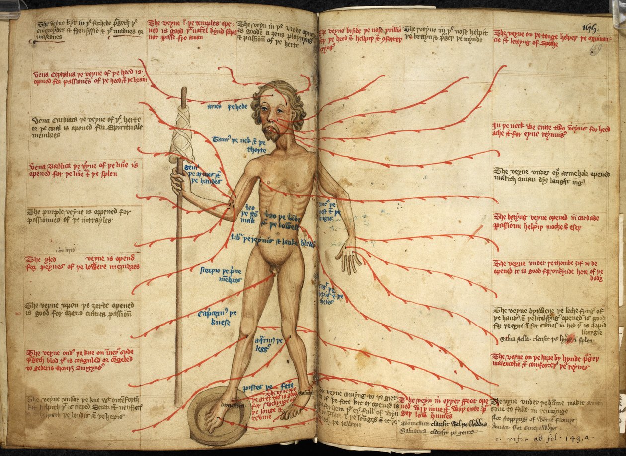 Harley 3719, ff.158v-159 Miniature af en blodårende mand med den ene fod i en blødende pande og en spindel i hånden, illustration fra 