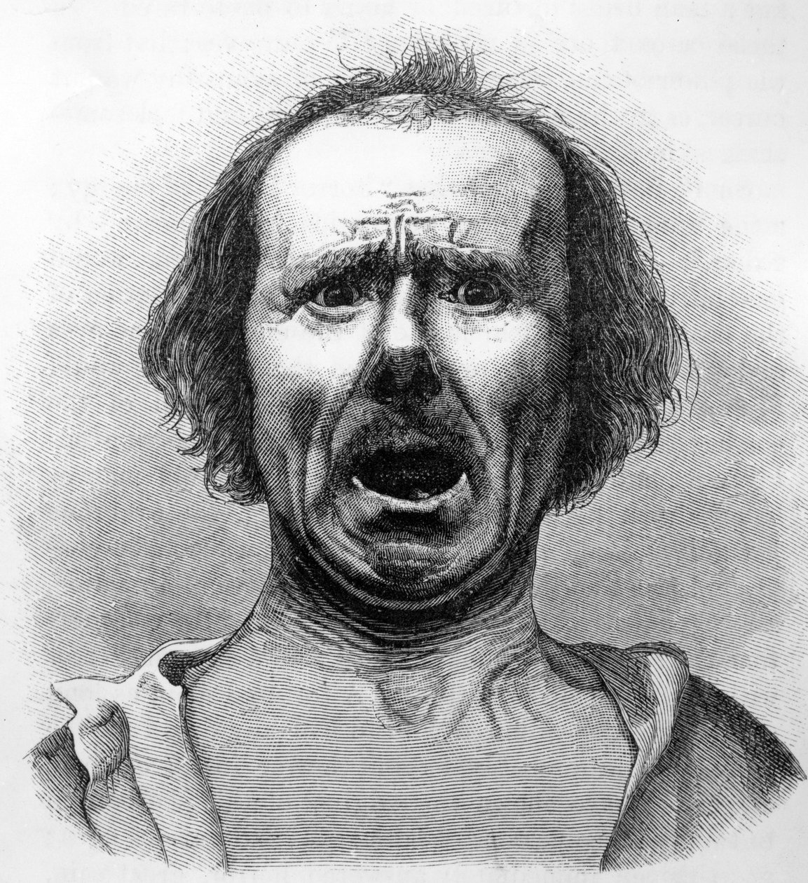 Horror and Agony, kopieret fra et fotografi af Dr. Duchenne, illustration fra 