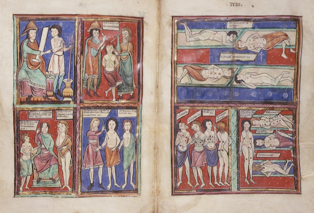 Sloane 1975 fol.91v-92 Medicinske scener af English School