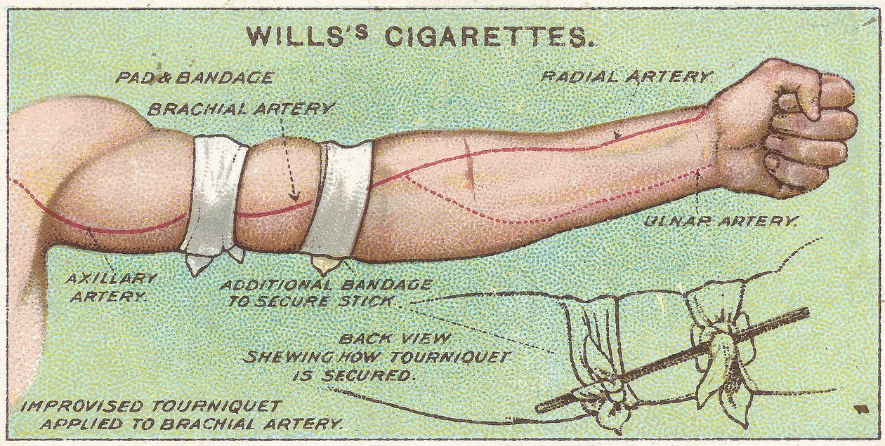 Tourniquet, nr. 11 fra First Aid-serien af Willss Cigarette-kort, 1913 af English School