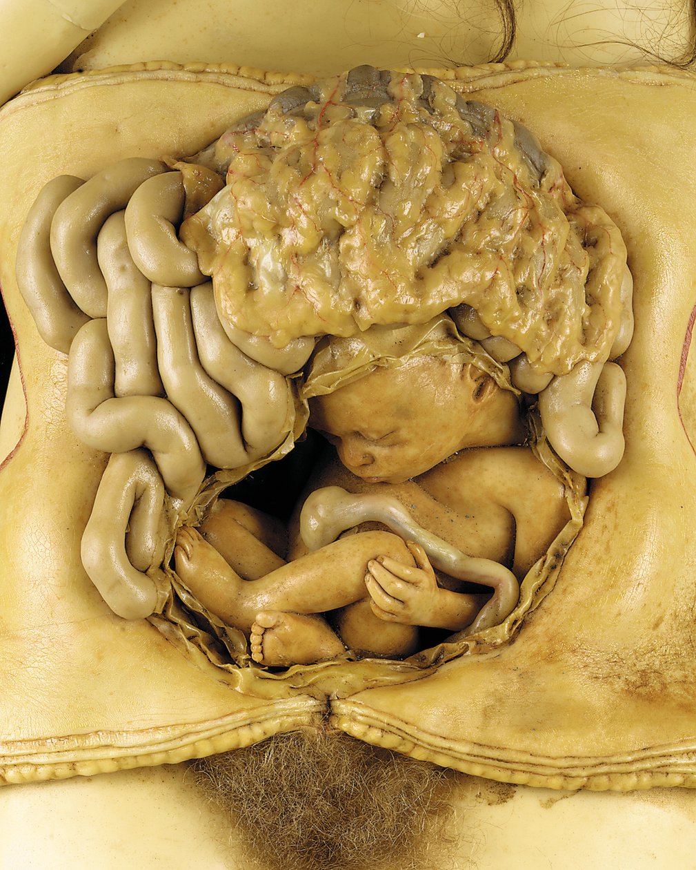 Anatomisk model af en ovariegraviditet, detaljer (voks) (se også 1126545-7) af European School