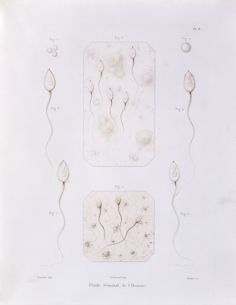 Sædvæske, fra Theorie Positive de lOvulation Spontanee et de la Fecondation des Mammiferes et de lEspece Humaine af Felix-Archimede Pouchet (1800-72) graveret af Oudet, Paris, 1847 (farvet eng. af Felix Archimede Pouchet