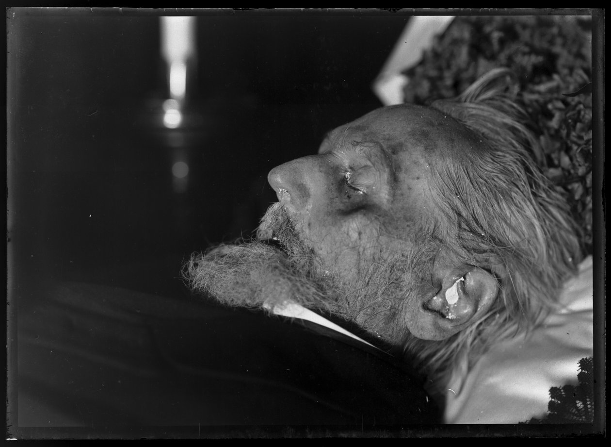 Rudolf af Antiken (1812-1905) på dødslejet af Ferdinand Schmutzer