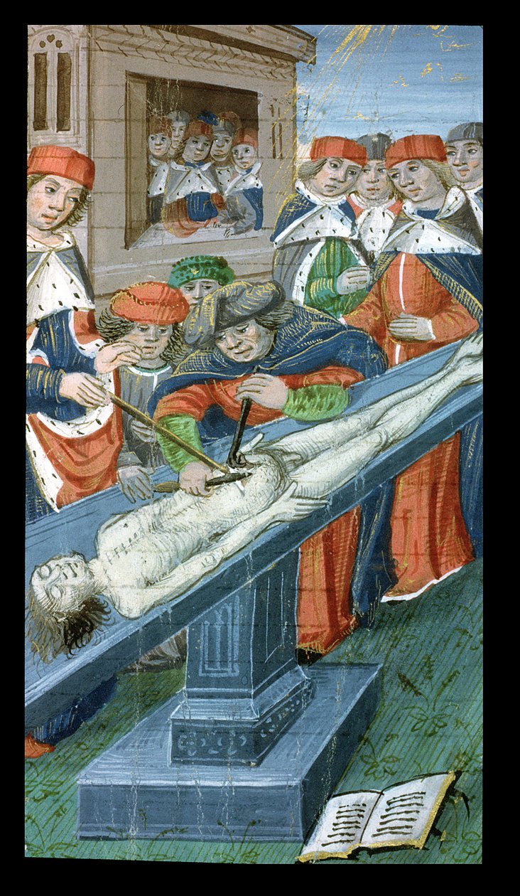 Ms Hunter 9 10r Dissection, fra De Medina Fen I. II, af Avicenna (980-1037) af Flemish School