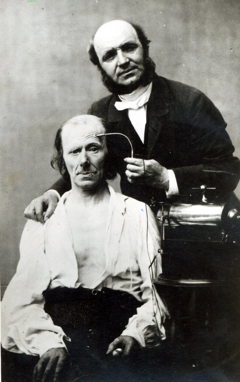 Duchenne de Boulogne med en patient, 1862 af French Photographer