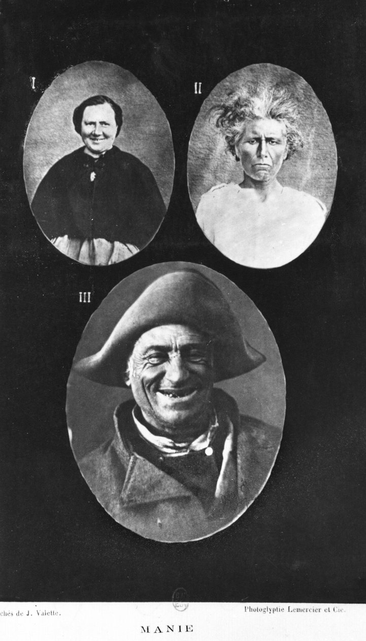 Mani, illustration fra Nouveau traite elementaire et pratique des maladies mentales af Henri Dagonet (1823-1902) Paris, Bailliere, 1876 af French Photographer