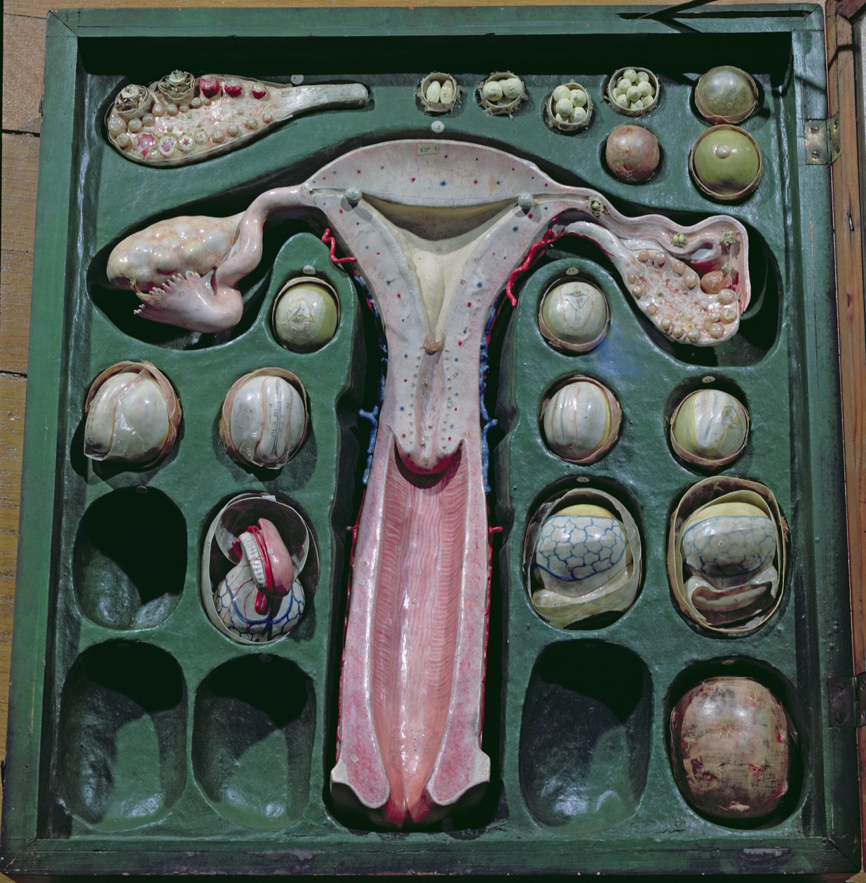 Kvindelige kønsorganer, ca. 1830 (malet pap) af French School