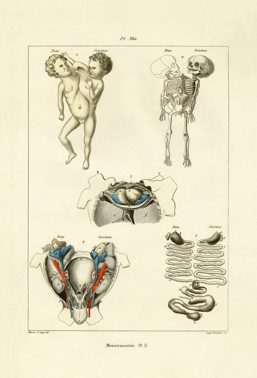 Freak, 1833-39 af French School