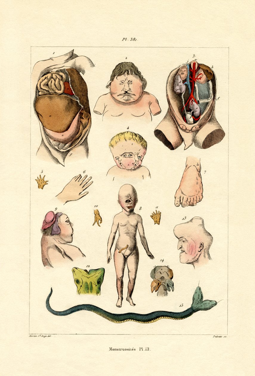 Freak, 1833-39 af French School