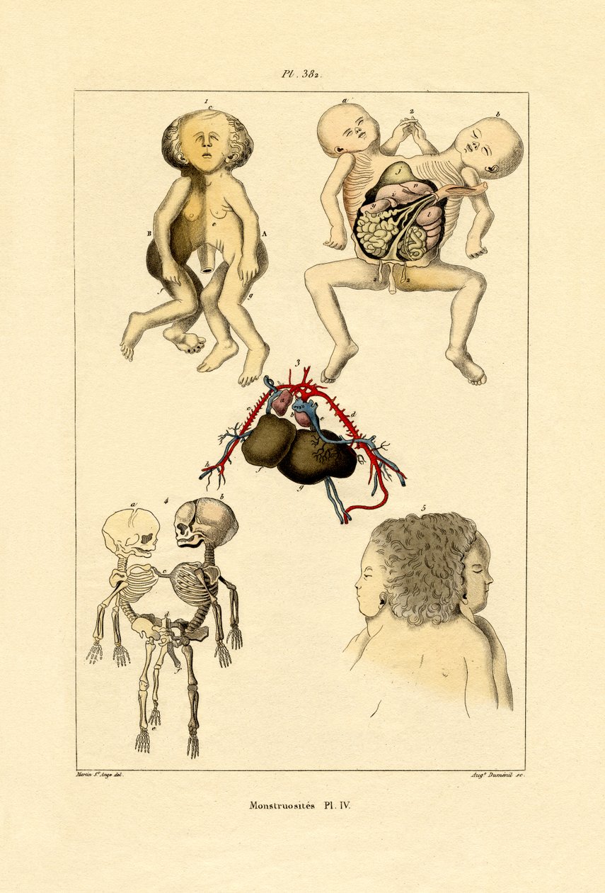 Freak, 1833-39 af French School
