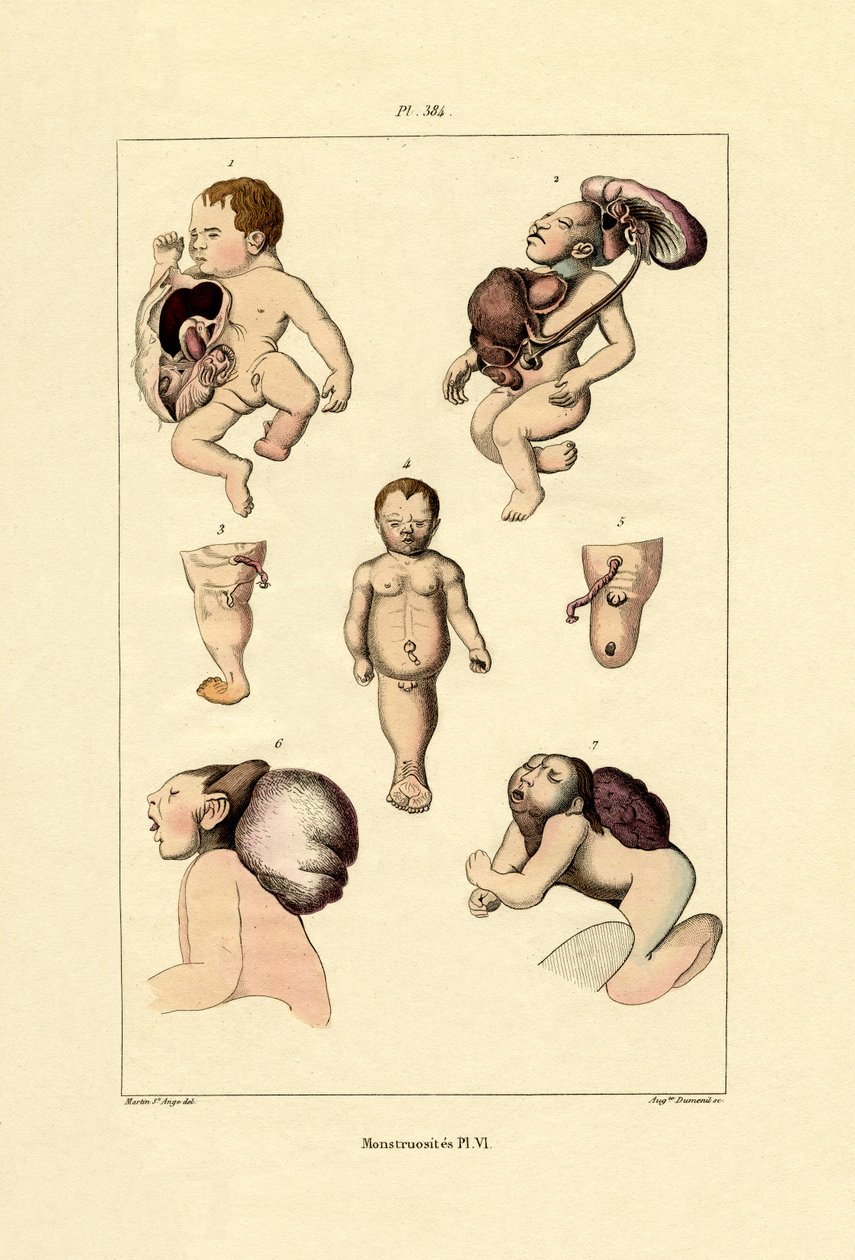 Freak, 1833-39 af French School